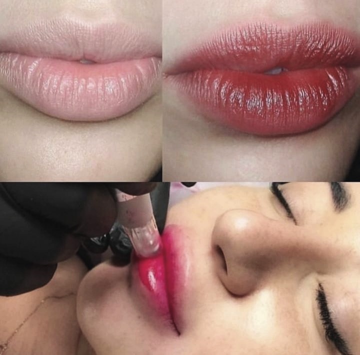 BB Lips Anwendung